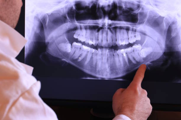 Best Emergency Dental Extractions in Lynn, IN